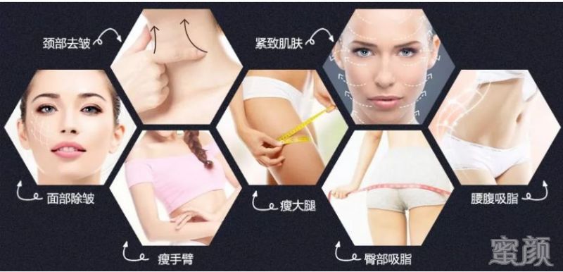 https://img.miyanlife.com/mnt/timg/200318/12263415O-16.jpg