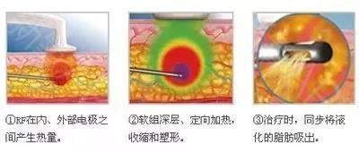 https://img.miyanlife.com/mnt/timg/200318/1226345Q3-15.jpg