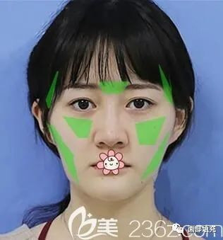 https://img.miyanlife.com/mnt/timg/200318/1511225161-1.jpg