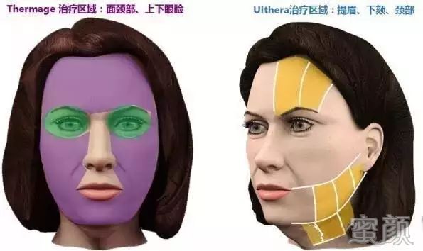 https://img.miyanlife.com/mnt/timg/200318/1532264515-8.jpg