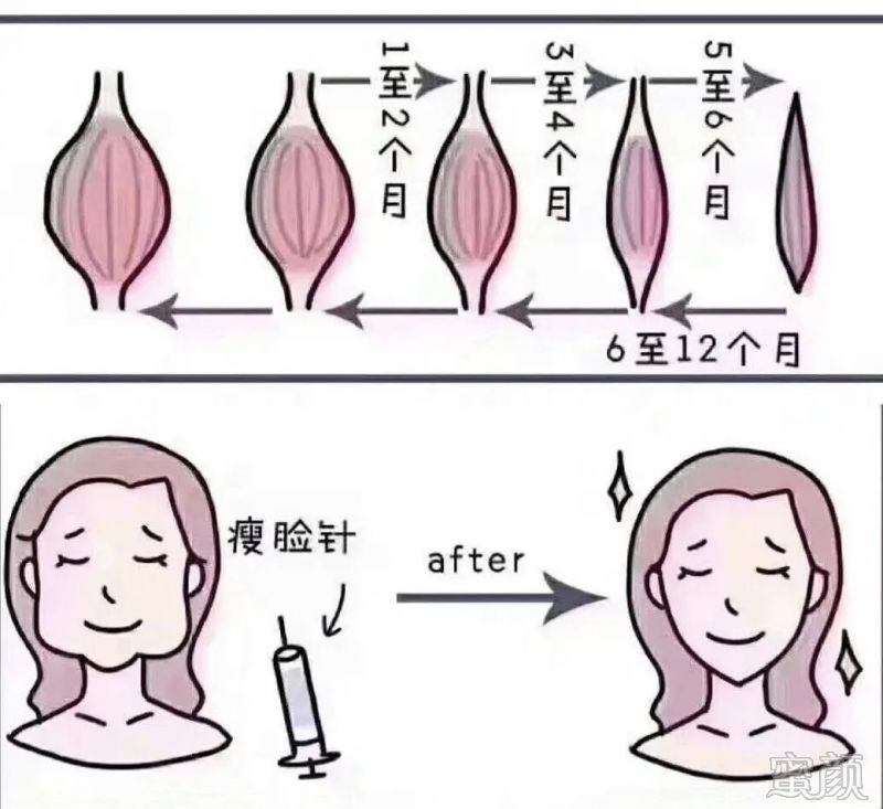 https://img.miyanlife.com/mnt/timg/200319/1420152957-1.jpg