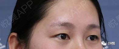 https://img.miyanlife.com/mnt/timg/200319/14464M600-4.jpg