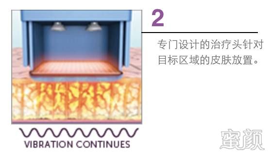 https://img.miyanlife.com/mnt/timg/200320/12554A954-2.jpg