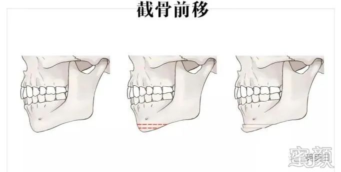 案例图片