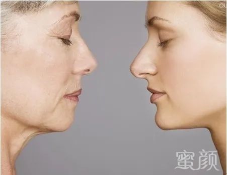https://img.miyanlife.com/mnt/timg/200321/131J63602-4.jpg