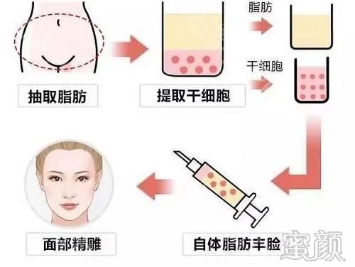 https://img.miyanlife.com/mnt/timg/200321/131JK452-6.jpg