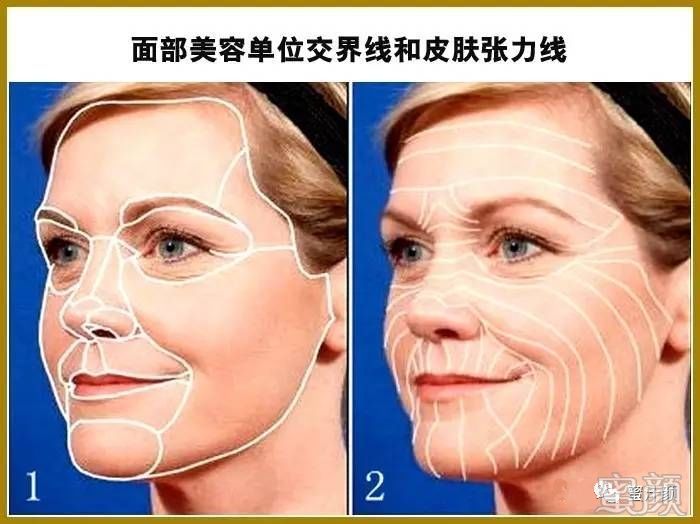 https://img.miyanlife.com/mnt/timg/200321/1330062148-3.jpg