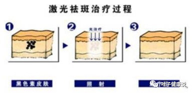 https://img.miyanlife.com/mnt/timg/200321/13343945S-1.jpg
