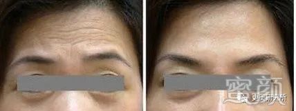 https://img.miyanlife.com/mnt/timg/200321/1354401147-14.jpg