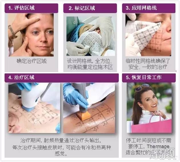 https://img.miyanlife.com/mnt/timg/200326/122H12Y9-5.jpg