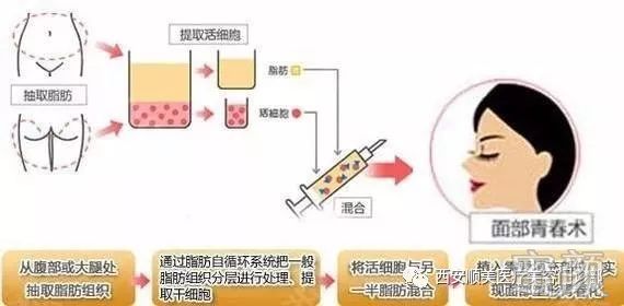 https://img.miyanlife.com/mnt/timg/200326/1240314056-3.jpg