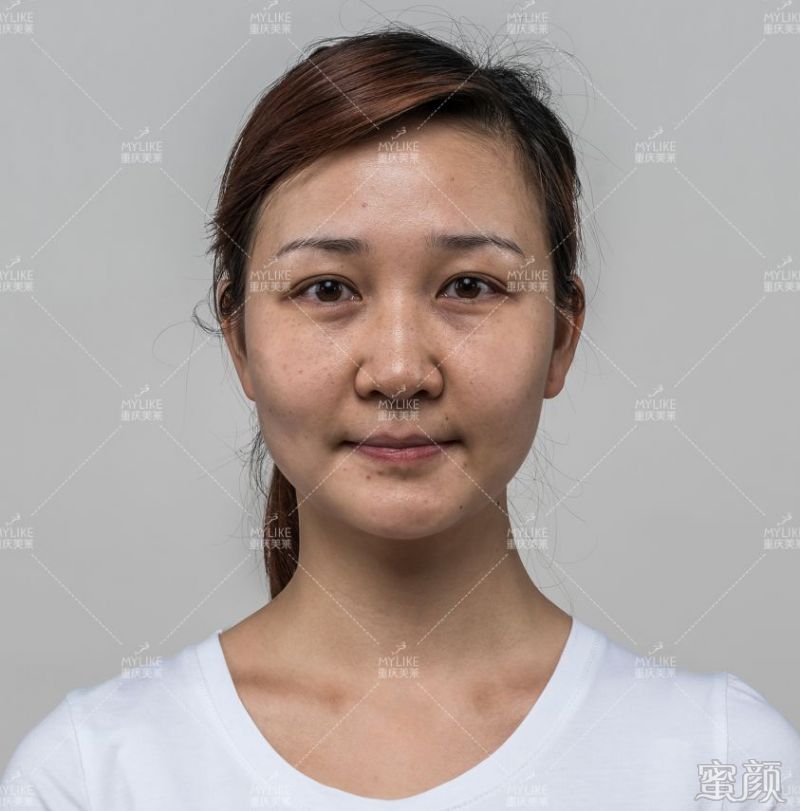 https://img.miyanlife.com/mnt/timg/200326/1254333564-10.jpg