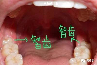 案例图片