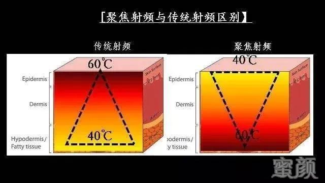 https://img.miyanlife.com/mnt/timg/200326/1P0464412-3.jpg
