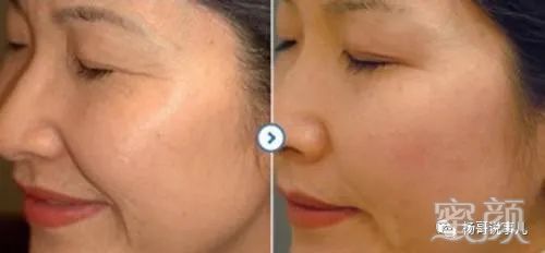 https://img.miyanlife.com/mnt/timg/200328/1122194242-2.jpg 案例图片