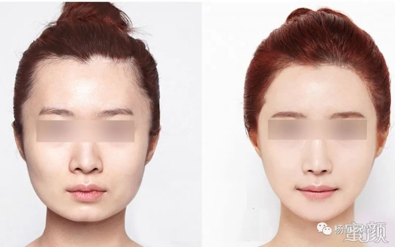 https://img.miyanlife.com/mnt/timg/200328/11221R3F-1.jpg 案例图片