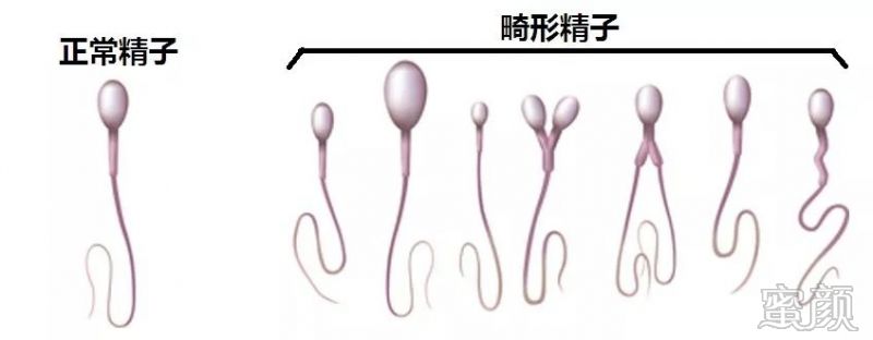https://img.miyanlife.com/mnt/timg/200328/12331W3W-6.jpg