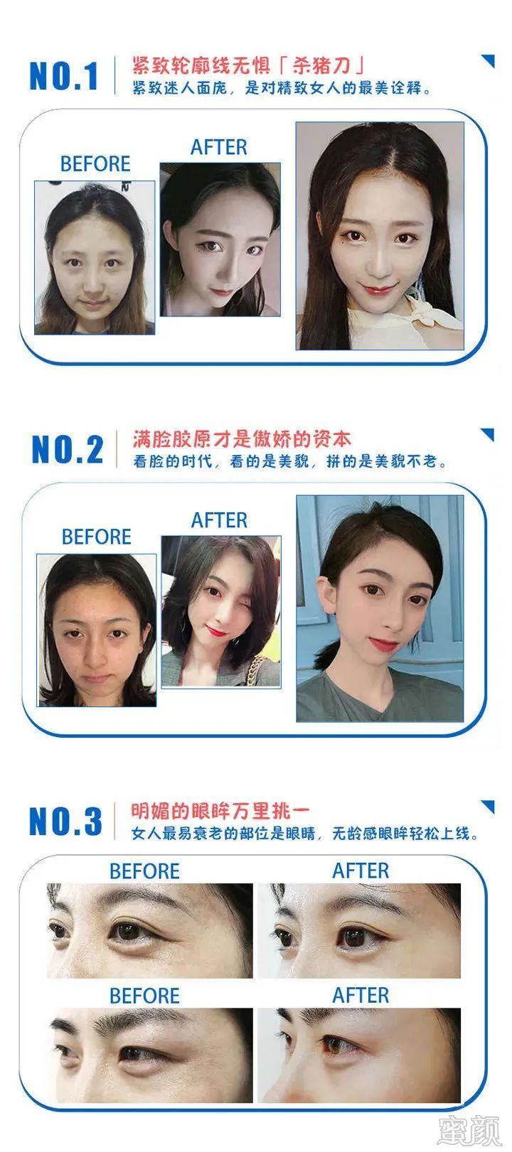 https://img.miyanlife.com/mnt/timg/200328/141529AF-13.jpg