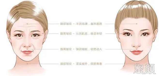 https://img.miyanlife.com/mnt/timg/200328/14152I339-10.jpg