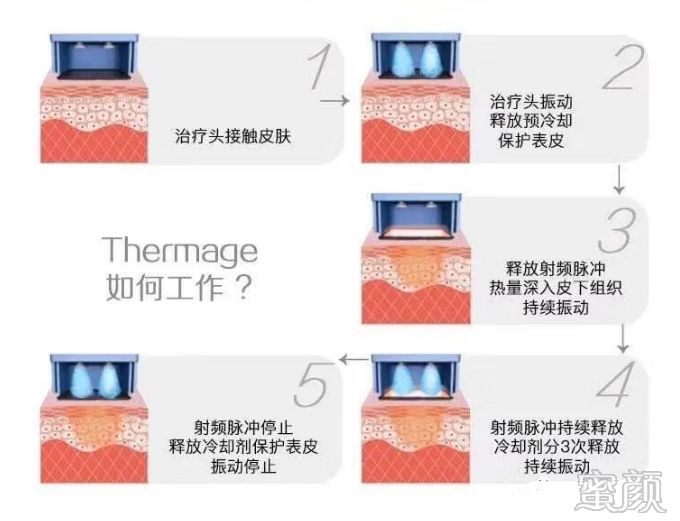 https://img.miyanlife.com/mnt/timg/200329/1414335107-0.jpg