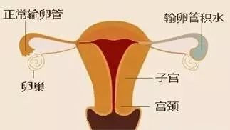 https://img.miyanlife.com/mnt/timg/200329/15002I0P-1.jpg