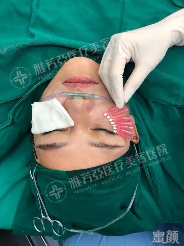 https://img.miyanlife.com/mnt/timg/200330/1312105H5-2.jpg