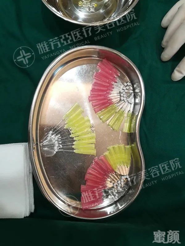https://img.miyanlife.com/mnt/timg/200330/131211Ma-3.jpg