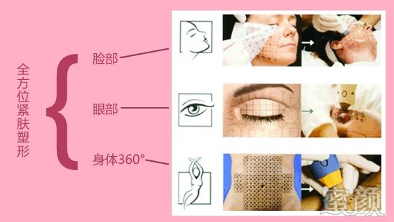 https://img.miyanlife.com/mnt/timg/200407/1T1351Y3-6.jpg