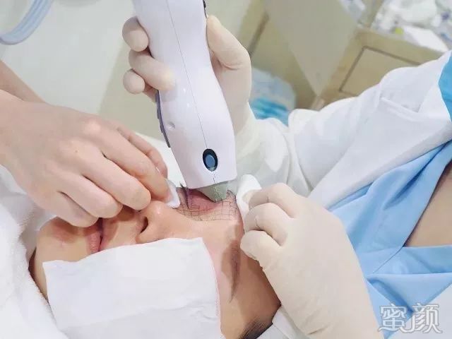 https://img.miyanlife.com/mnt/timg/200407/1T1562918-11.jpg