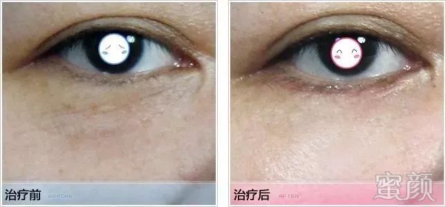 https://img.miyanlife.com/mnt/timg/200407/1T1564112-13.jpg