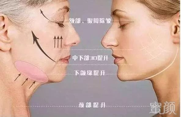 https://img.miyanlife.com/mnt/timg/200407/1T1564A6-12.jpg