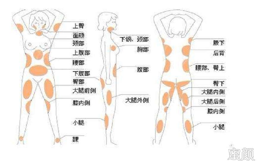 https://img.miyanlife.com/mnt/timg/200407/1TKG356-5.jpg
