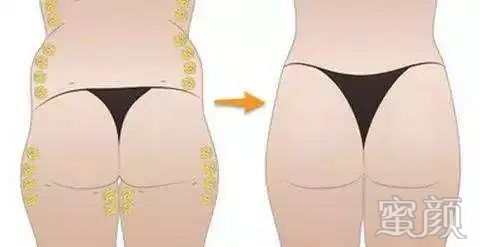https://img.miyanlife.com/mnt/timg/200407/1TKK331-3.jpg