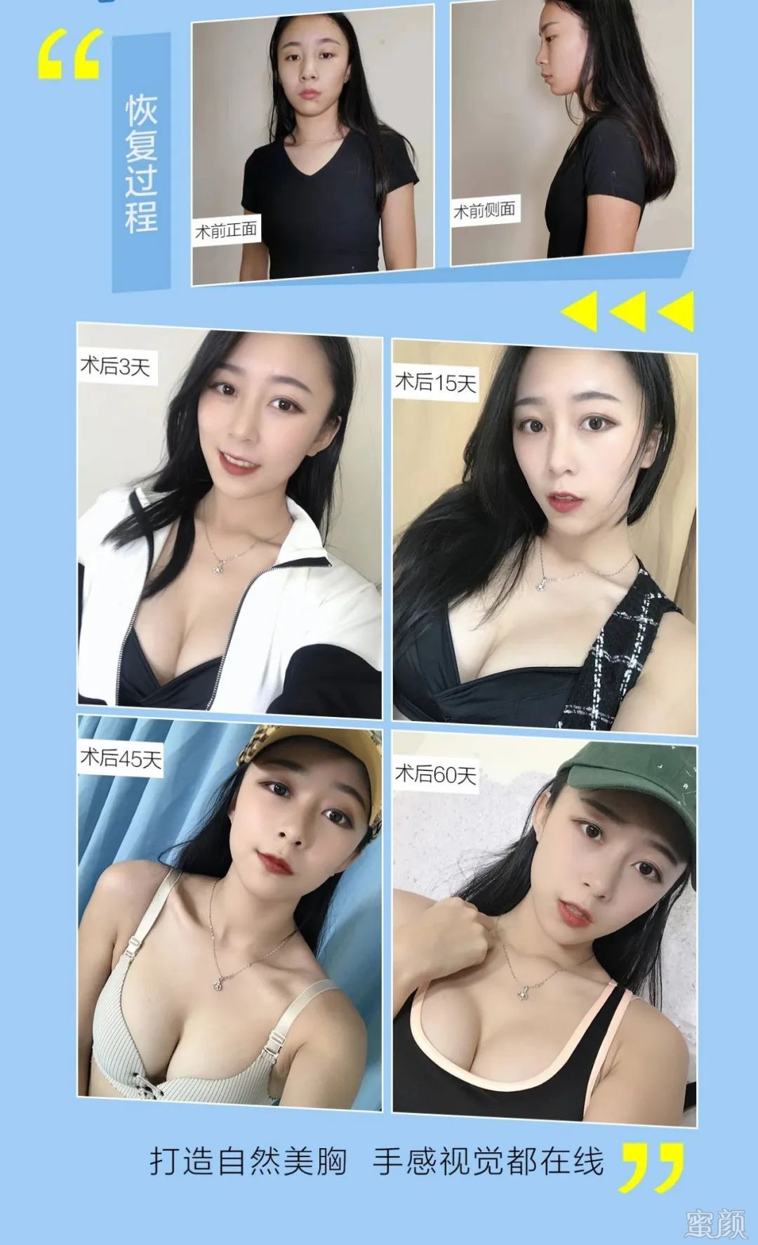 https://img.miyanlife.com/mnt/timg/200407/1Z1513J9-7.jpg