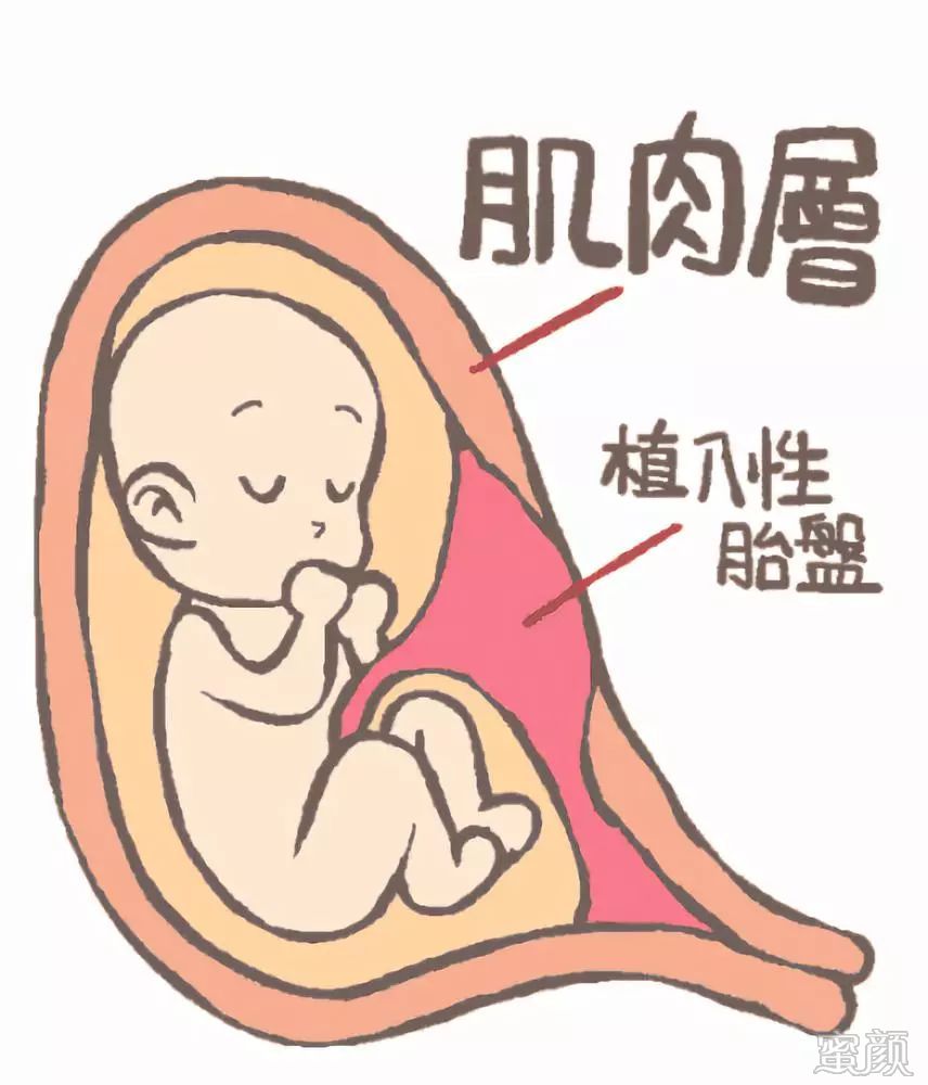 https://img.miyanlife.com/mnt/timg/200408/1420154396-1.jpg