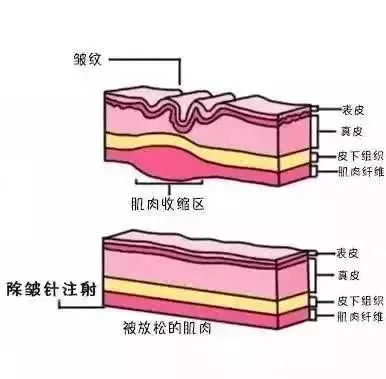 https://img.miyanlife.com/mnt/timg/200408/143Q62L0-5.jpg