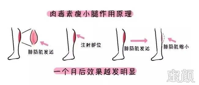 https://img.miyanlife.com/mnt/timg/200408/143QC227-4.jpg