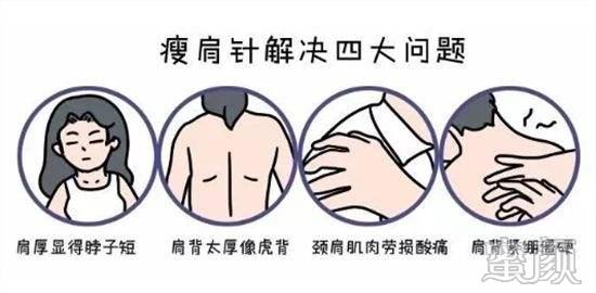 https://img.miyanlife.com/mnt/timg/200408/143QC536-3.jpg