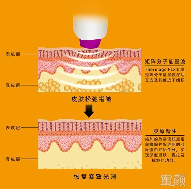 https://img.miyanlife.com/mnt/timg/200408/1455262314-1.jpg