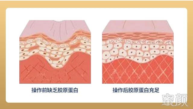 https://img.miyanlife.com/mnt/timg/200408/14552Q649-5.jpg