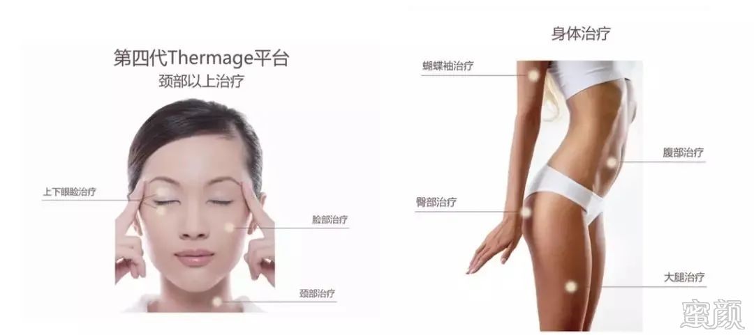 https://img.miyanlife.com/mnt/timg/200408/153A1GW-10.jpg