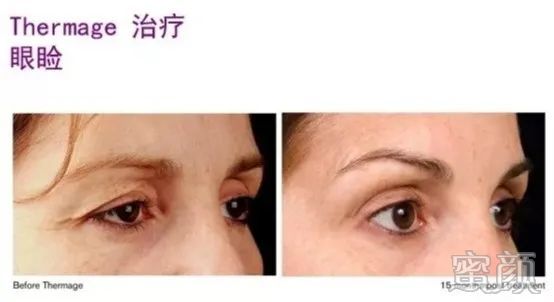 https://img.miyanlife.com/mnt/timg/200408/153A34550-13.jpg
