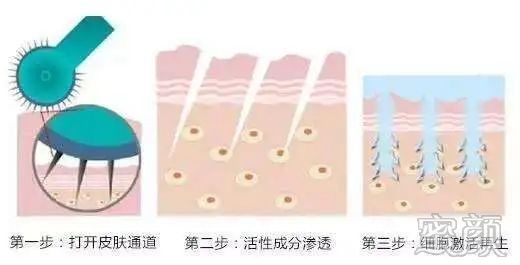 https://img.miyanlife.com/mnt/timg/200408/15534255F-0.jpg