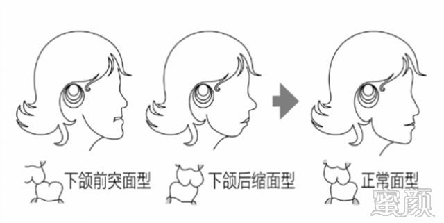 https://img.miyanlife.com/mnt/timg/200409/121030C12-1.jpg
