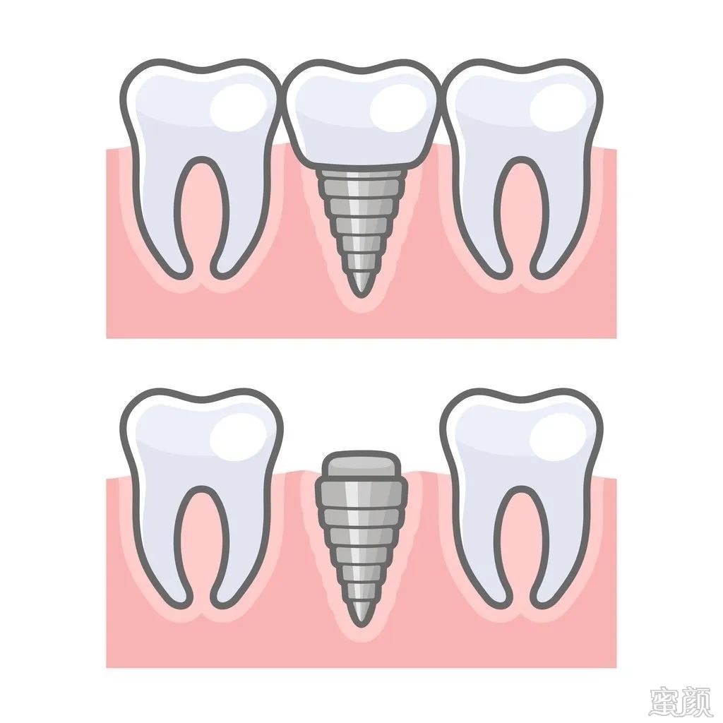 案例图片