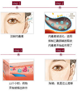 https://img.miyanlife.com/mnt/timg/200410/1352095Y0-1.jpg