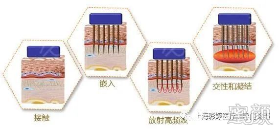 https://img.miyanlife.com/mnt/timg/200410/140035B51-4.jpg