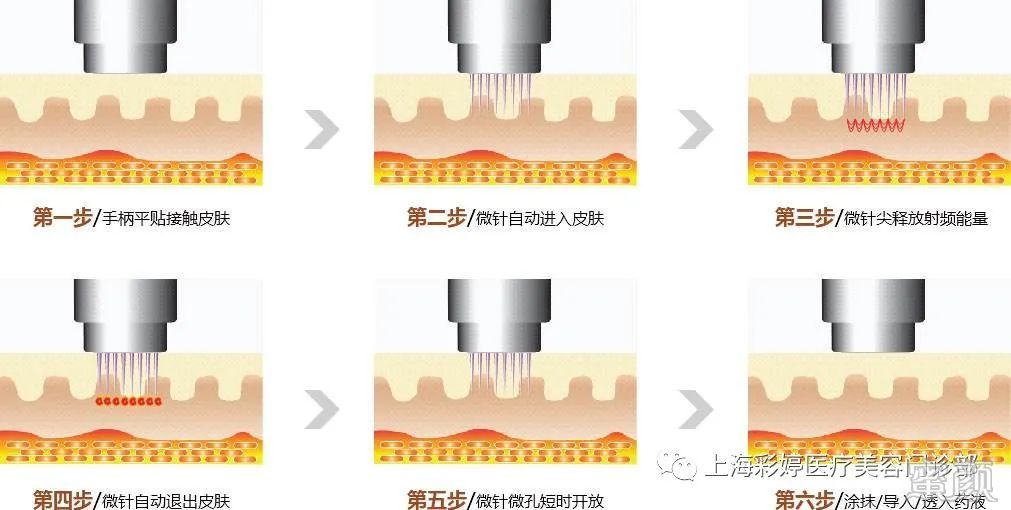 https://img.miyanlife.com/mnt/timg/200410/14003BD1-5.jpg
