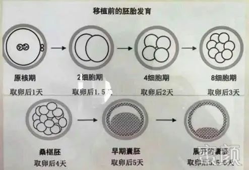 https://img.miyanlife.com/mnt/timg/200410/145R614Q-0.jpg