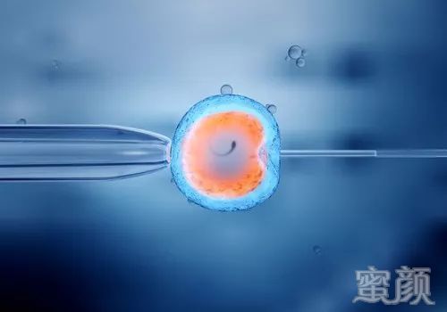 https://img.miyanlife.com/mnt/timg/200410/1503223342-3.jpg